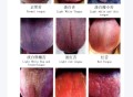舌诊图解7天学会加视频教程