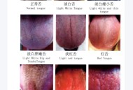 舌诊图解7天学会加视频教程