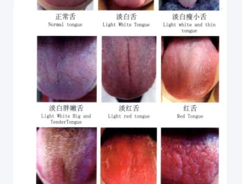 舌诊图解7天学会加视频教程