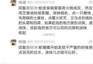 蛇缠腰分享两个方子一个严重用，一个不严重的用